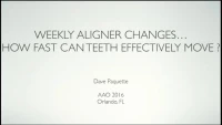 Thumbnail for Accelerated Treatment or Accelerated Delivery: Is There a Difference?