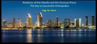 Thumbnail for Rotations of the Maxilla and the Occlusal Plane: The Key to Successful Orthopedics