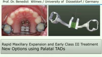 Thumbnail for Rapid Maxillary Expansion and Early Class III Treatment: New Options using Palatal TADs