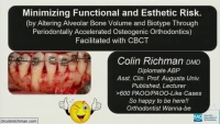 Thumbnail for Minimizing Esthetic and Functional Risk through POPA