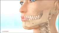 Thumbnail for Balancing the Facial Icon with a Minimally Invasive Approach