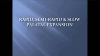 Thumbnail for Rapid, Semi-rapid and Slow Palatal Expansion