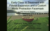 Thumbnail for Early Class III Treatment with Palatal Expansion and a Custom Made Protraction Facemask