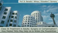 Thumbnail for Class III Treatment in Adults: Surgery or Compensation? How Palatal TADs May Help Us to Widen the Possibilities