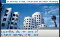 Thumbnail for Expanding the Horizons of Aligner Therapy with TADs