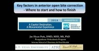 Thumbnail for Key Factors in Anterior Open Bite Correction: Where to Start and How to Finish