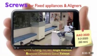 Thumbnail for TAD Mechanics for Fixed Appliances and Aligners