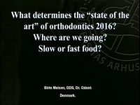 Thumbnail for 2016 AAO Annual Session - Angle Lecture: Fast Food or Slow Food Orthodontics / Biomechanics: Past, Present and Future! / "Reversal of Fortune": Resolving Final Excess Overjet Using Simplified Orthodontic Mechanics