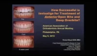 Thumbnail for 2013 Annual Session - Treatment of Deep and Open Bite with Clear Aligners without Orthognathic Surgery or Microimplants / Not Just an Orthodontist, but Part of the Comprehensive Dental Team