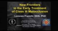 Thumbnail for 2013 Annual Session - New Frontiers in the Early Treatment of Class III Malocclusion / Advances in Regional Corticotomies