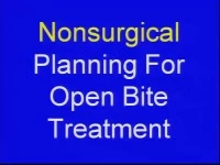 Thumbnail for 2011 Annual Session - Nonsurgical Planning for Open Bite Treatment / Treating Open Bite at Different Ages