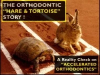 Thumbnail for 2015 AAO Annual Session - The Orthodontic 'Hare & Tortoise' Story: A Reality Check on Accelerated Tooth Movement / Corticotomy-assisted Accelerated Space Closure of a Missing Molar by Utilizing the Third Molar 