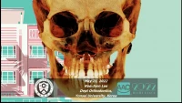 Thumbnail for Facts about Maxillary Expansion in Adults: Fracture or Remodeling?