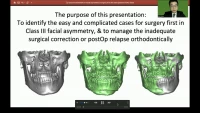 Thumbnail for Class III Treatment in Facial Asymmetry: Surgery First for Adult Patients