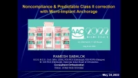 Thumbnail for Noncompliance & Predictable Class II Correction with Micro-Implant Anchorage