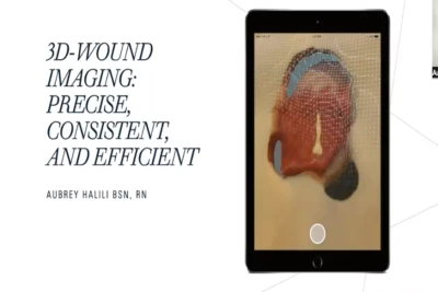 Thumbnail for 3D-Wound Technology: Precise, Consistent, and Efficient