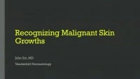 Thumbnail for Recognizing Malignant Skin Growths