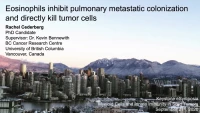 Thumbnail for Short Talk: Eosinophils Inhibit Pulmonary Metastasis and Directly Kill Tumor Cells