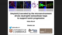 Thumbnail for Short Talk: Amyloid β Secreted by the Tumor Microenvironment Drives Neutrophil Extracellular Traps Production to Support Tumor Progression