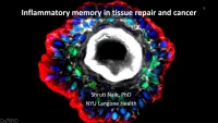 Thumbnail for Eavesdropping on the Conversation between Immune and Epithelial Stem Cells during Tissue Repair