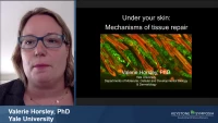 Thumbnail for All Aboard: Adipocyte Function in Tissue Repair