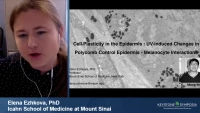 Thumbnail for Chromatin Regulation of Skin Development and Skin Stem Cells