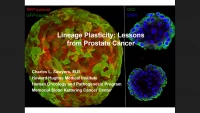Thumbnail for Lineage Plasticity: Lessons from Prostate Cancer