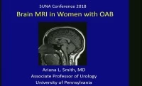 Thumbnail for Brain MRI in Women with Overactive Bladder (OAB)