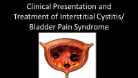 Thumbnail for Clinical Presentation and Treatment of Bladder Pain Syndrome/Interstitial Cystitis