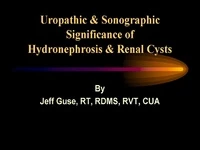 Thumbnail for The Uropathic and Sonographic Significance of Hydronephrosis and Renal Cysts
