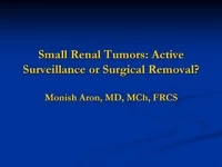 Thumbnail for Small Renal Tumors: Active Surveillance or Surgical Removal?