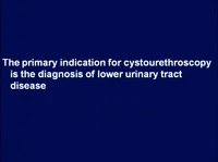 Thumbnail for Advanced Practice Cystoscopy