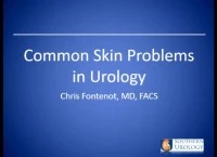 Thumbnail for Dermatology Conditions in Urology