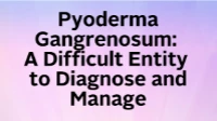 Thumbnail for Pyoderma Gangrenosum: A Difficult Entity to Diagnose and Manage