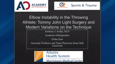 Thumbnail for Elbow Instability in the Throwing Athlete: Tommy John Light Surgery and Modern Variations on the Technique