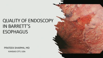 Thumbnail for ASGE & European Society of Gastrointestinal Endoscopy (ESGE)