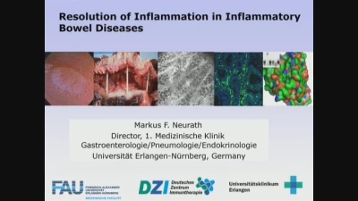 Thumbnail for Intestinal Regeneration and Repair in IBD — Taking the Fuel Away From the Fire