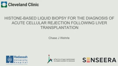 Thumbnail for Cirrhosis and Liver Transplantation