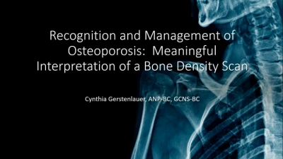 Thumbnail for Recognition and Management of Osteoporosis