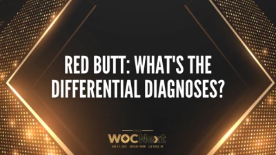 Thumbnail for Red Butt: What's the Differential Diagnoses?